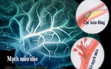 Những triệu chứng cần lưu ý cho người cao tuổi